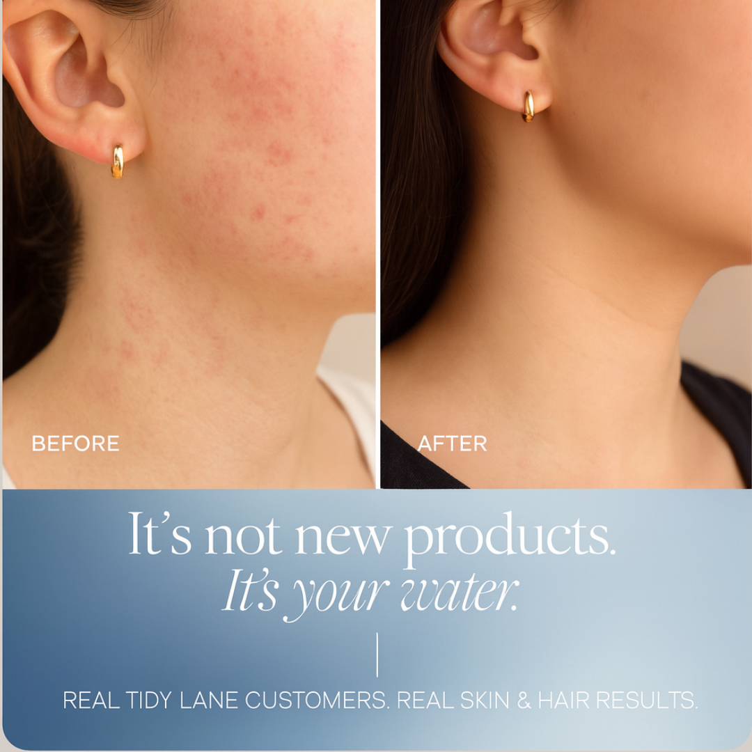 Australia’s #1 Premium Shower Filter™